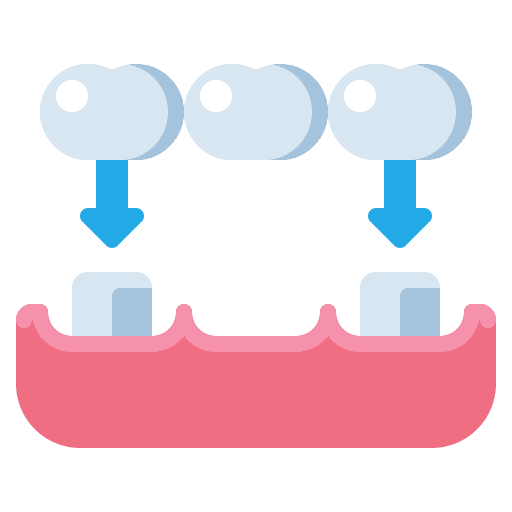 Crowns & Bridges
