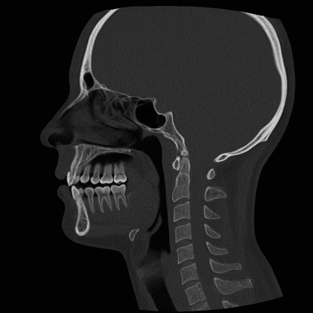Digital X-Ray & Diagnosis